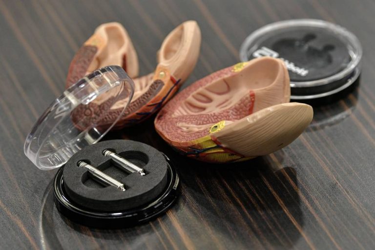 IJN becomes first in Southeast Asia to implant dual-chamber leadless pacemaker